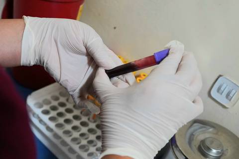 ‘Parecía sarna y dolía como si me hubieran golpeado el estómago’, dice mujer que contrajo dengue: hay 13.075 casos en Ecuador en este 2024