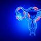 Cómo reconocer la endometriosis, que afecta al 10 % de las mujeres en edad reproductiva