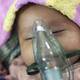 Los ingeniosos inventos que salvan la vida de niños que necesitan oxígeno desesperadamente