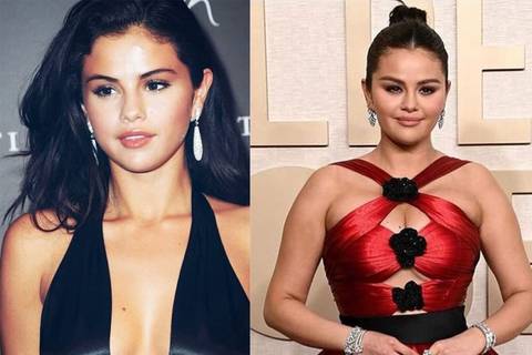 El antes y después de Selena Gomez: Qué es el body shaming que ha sufrido la actriz y otras estrellas de la generación Z como Billie Eilish, Zendaya y Camila Cabello