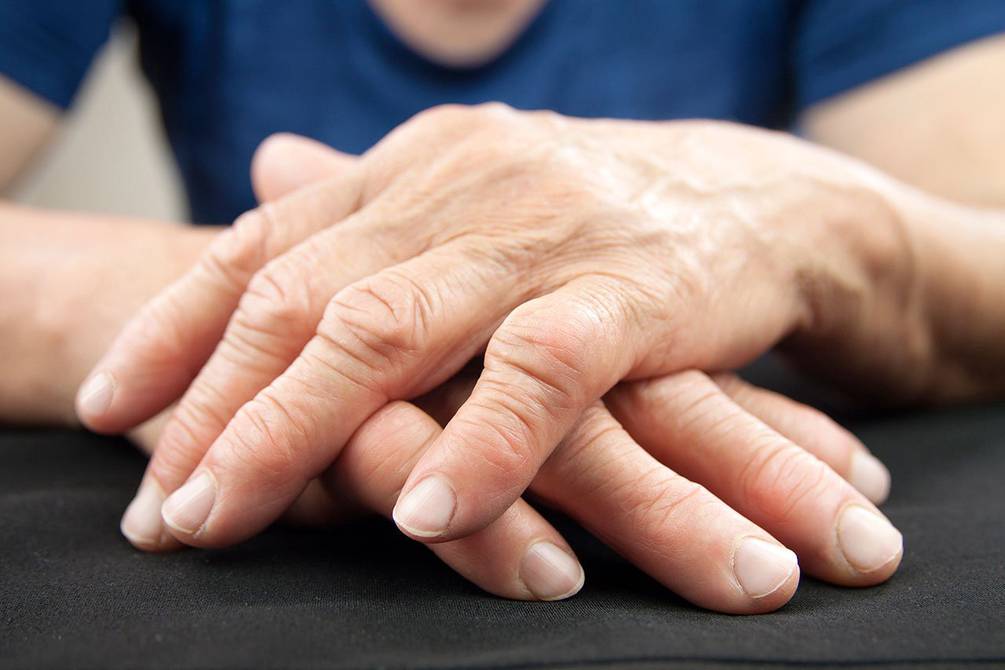 ladrar Fatídico rebanada Los síntomas cuando tienes el ácido úrico alto | Salud | La Revista | El  Universo