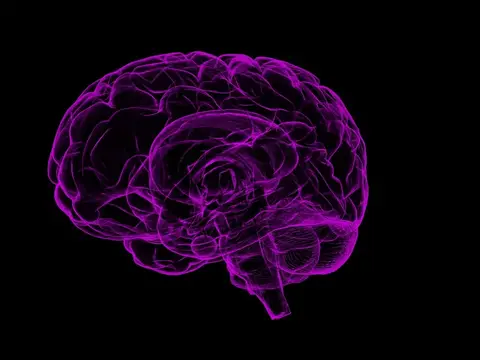 Científicos usan inteligencia artificial que lee escáneres cerebrales para encontrar genes del Alzheimer