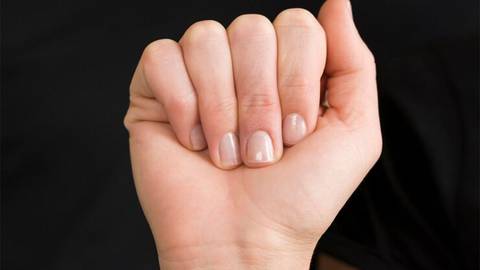 Los síntomas de un tipo de artritis que se manifiestan en las uñas y pueden confundirse con hongos