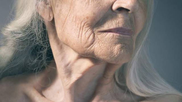 Esta es la enfermedad avanzada de la tiroides que puedes padecer si eres mujer y tienes más de 60 años