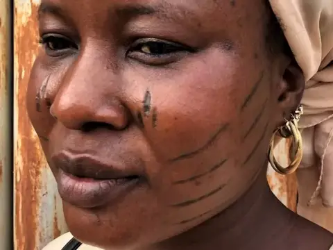Cicatrices faciales: la violenta práctica a niños que es vista en África como símbolo de orgullo y belleza