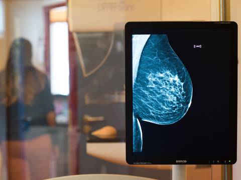 Cómo detectar a tiempo un cáncer de mama