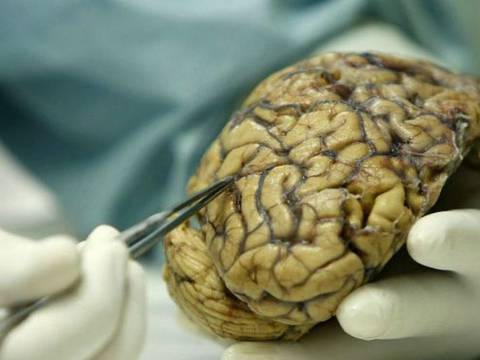 Inteligencia artificial permite diagnóstico de cáncer de cerebro en medio de la cirugía