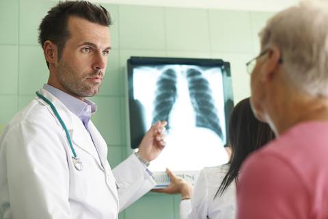 ¿Qué es el cáncer de pulmón metastásico? Síntomas y tratamiento cuando la enfermedad ya alcanzó el grado 4