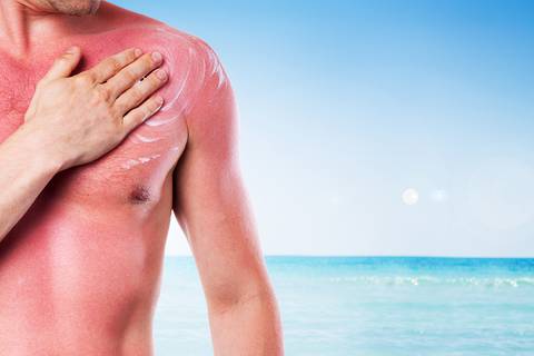 ¿Cuáles son los efectos de los rayos UV en la piel?