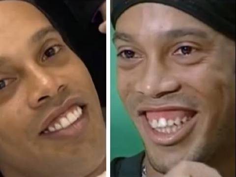 Cambio extremo de Ronaldinho