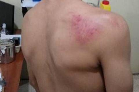 Estudiante se recupera luego de enfrentamiento con compañero de colegio, en Manabí