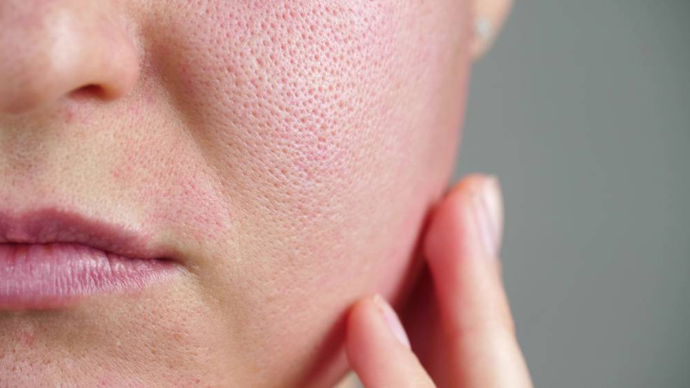 La rutina correcta para mejorar el de los poros cara | Salud | La Revista | El Universo
