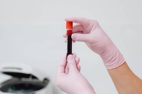 ¿Puedo contraer VIH con inyecciones cosméticas? El polémico caso de las mujeres infectadas al practicarse un ‘facial de vampiro’
