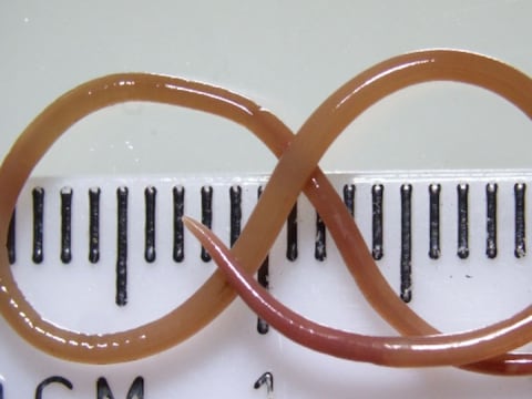 Extraen gusano parásito rojo del cerebro de una mujer: durante un año le causó infección pulmonar, daño orgánico, pérdida de la memoria y depresión