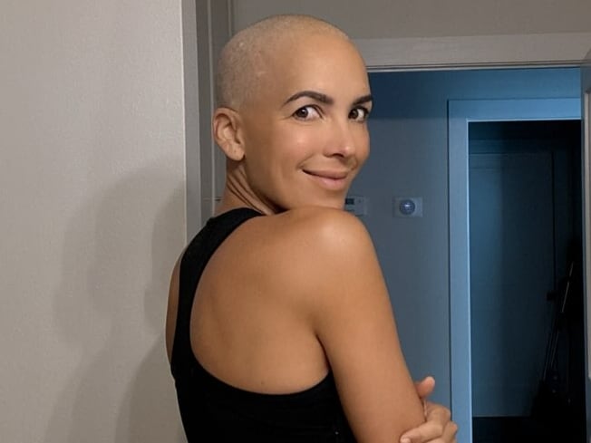 María Teresa ‘Flaca’ Guerrero no se rinde: Fui imagen orgullosa de productos para el pelo durante años… y perderlo ha sido duro