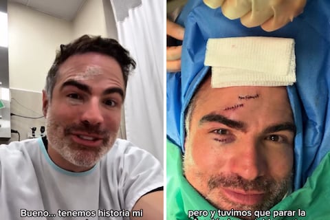 Roberto Manrique sufre un accidente en el teatro: Fue operado en el rostro de emergencia