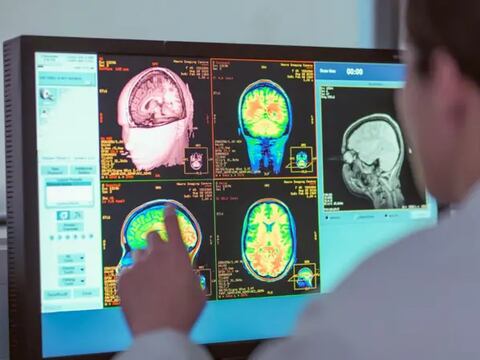 La adolescencia dura hasta los 30 años, según un nuevo estudio (y cuáles son las otras edades clave para el cerebro)