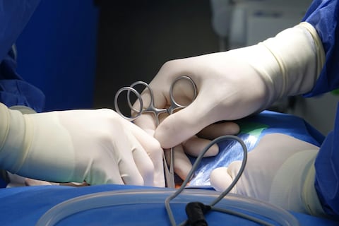 CDC confirma un raro caso de rabia transmitida por trasplante en EE. UU.