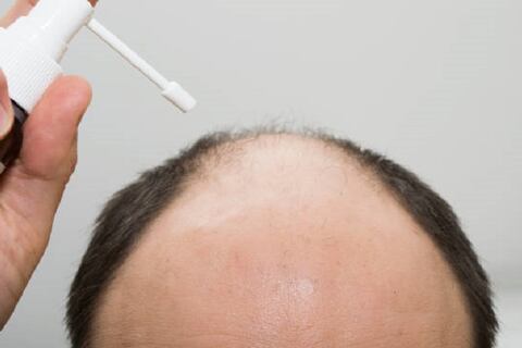 tamarindo para la caída del cabello: el remedio casero con vitaminas naturales que fortalece tu pelo