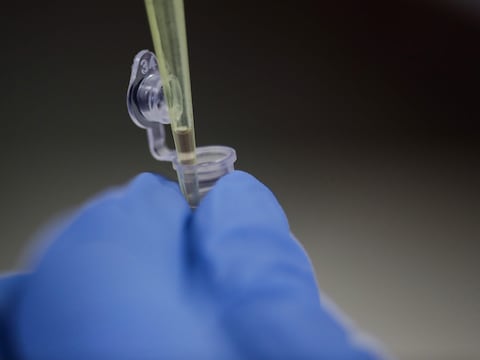 Sin mutaciones ni poderes especiales: Estudio sugiere que los virus zoonóticos que se transmiten a los humanos son sorprendentemente comunes