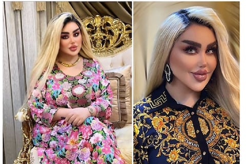 Ella es Dalia, la “Barbie iraquí” presentadora y actriz con más de 40 cirugías para ser como como la famosa muñeca