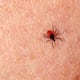 Mucho más peligroso que el Lyme: el extraño virus de la garrapata con un 10% de mortalidad que está creciendo en EE. UU.