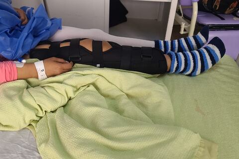 Sobreviviente de avalancha en el Cotopaxi lucha por salvar una de sus piernas: necesita cirugía urgente