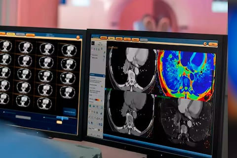 Ver más para vivir mejor