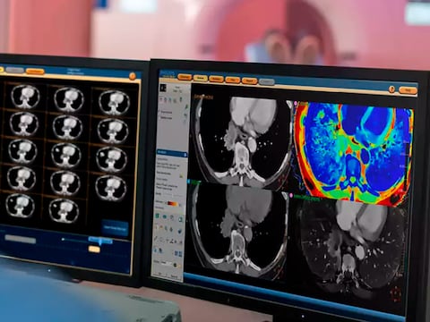 Ver más para vivir mejor