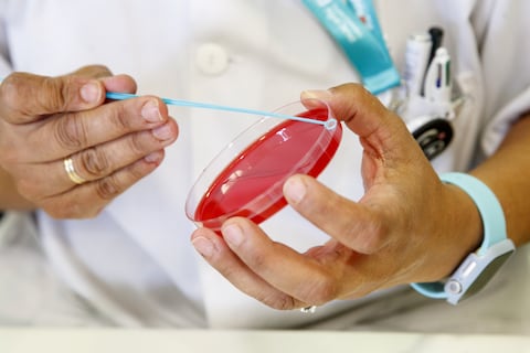 Aumentan los casos de sarampión en América, estos son los países con casos