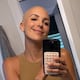 María Teresa ‘Flaca’ Guerrero se muestra sin pelo e invita a normalizar la imagen real de las pacientes oncológicas: “Esto también es fuerza”
