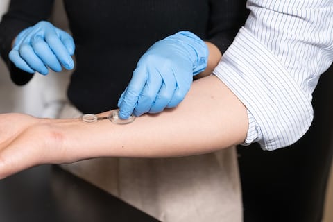 El invento para frenar las amputaciones por diabetes: así es el vendaje inteligente que detecta infecciones antes de que aparezcan los síntomas