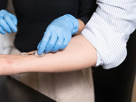 El invento para frenar las amputaciones por diabetes: así es el vendaje inteligente que detecta infecciones antes de que aparezcan los síntomas