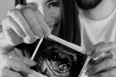 Dayanna Monroy espera a su primer bebé: Me está gustando todo, excepto las náuseas