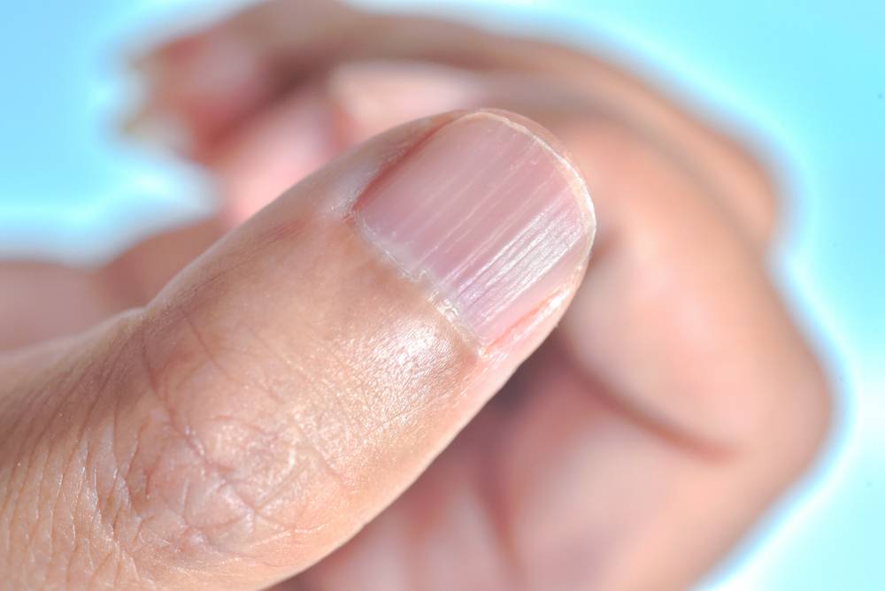 Qué dicen las uñas de su salud? Descubra las enfermedades que podría  padecer | Salud | La Revista | El Universo